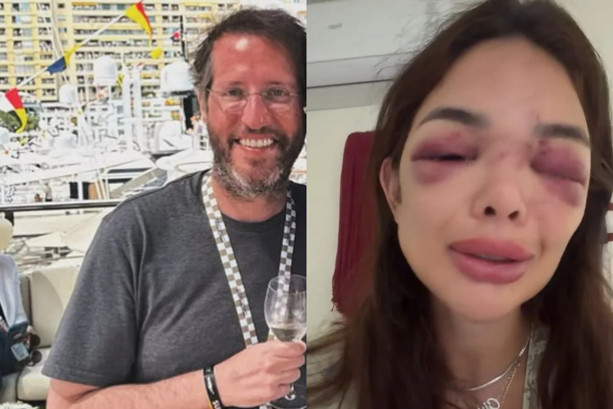 Empresário Ivo Kos e a cirurgiã-dentista Giullia Falcão Kos, de 27 anos - Metrópoles