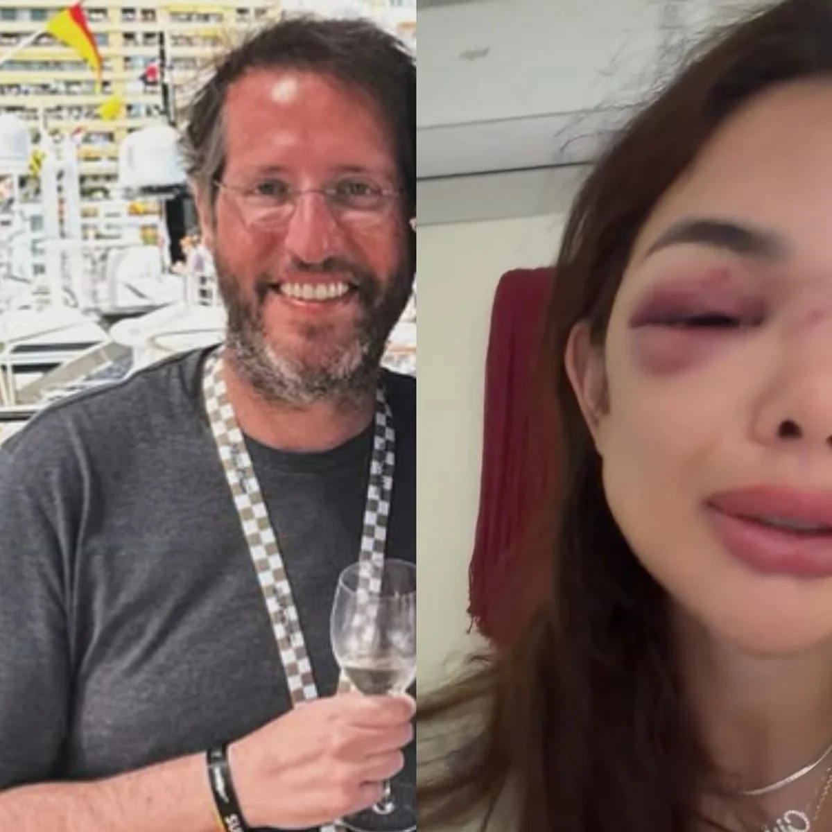 MPSP recorre de soltura de Ivo Kos, empresário acusado de agredir esposa