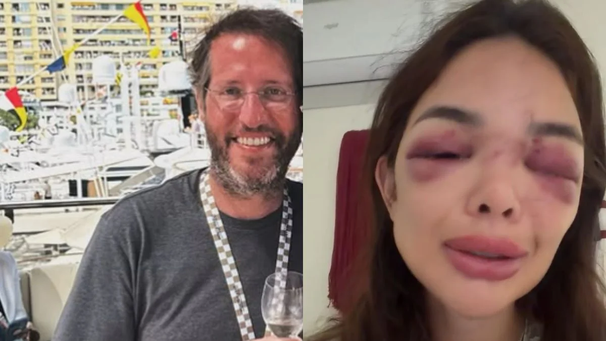 MPSP recorre de soltura de Ivo Kos, empresário acusado de agredir esposa